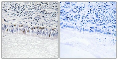 Anti-CLK1 antibody used in IHC (Paraffin sections) (IHC-P). GTX05111