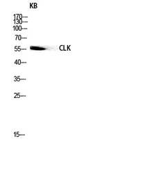 Anti-CLK1 antibody used in Western Blot (WB). GTX05111