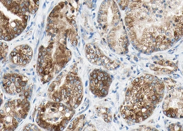 Anti-DRP1 (phospho Ser616) antibody used in IHC (Paraffin sections) (IHC-P). GTX05115