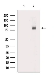 Anti-DRP1 (phospho Ser616) antibody used in Western Blot (WB). GTX05115