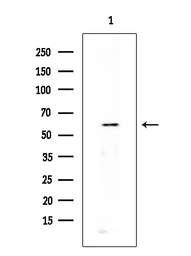 Anti-DRP1 (phospho Ser616) antibody used in Western Blot (WB). GTX05115