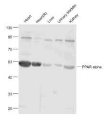 Anti-PPAR alpha antibody used in Western Blot (WB). GTX05116