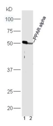 Anti-PPAR alpha antibody used in Western Blot (WB). GTX05116