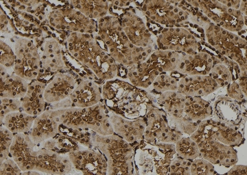 Anti-PKA C (phospho Thr198) antibody used in IHC (Paraffin sections) (IHC-P). GTX05119