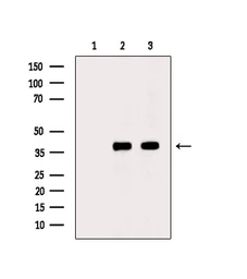 Anti-PKA C (phospho Thr198) antibody used in Western Blot (WB). GTX05119