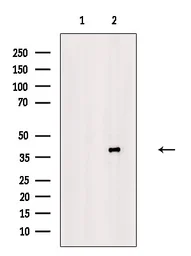 Anti-PKA C (phospho Thr198) antibody used in Western Blot (WB). GTX05119