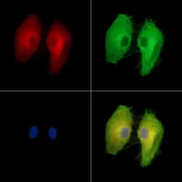 Anti-PI4 kinase beta antibody used in Immunocytochemistry/ Immunofluorescence (ICC/IF). GTX05120