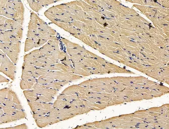 Anti-PI4 kinase beta antibody used in IHC (Paraffin sections) (IHC-P). GTX05120