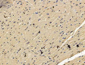Anti-PI4 kinase beta antibody used in IHC (Paraffin sections) (IHC-P). GTX05120