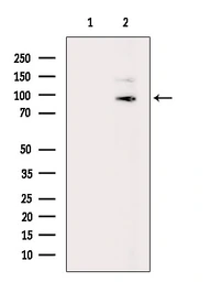 Anti-PI4 kinase beta antibody used in Western Blot (WB). GTX05120