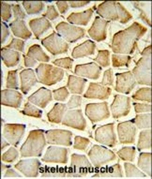 Anti-PI4 kinase beta antibody used in IHC (Paraffin sections) (IHC-P). GTX05121