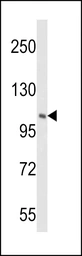 Anti-PI4 kinase beta antibody used in Western Blot (WB). GTX05121