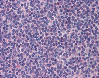 Anti-PML antibody used in IHC (Paraffin sections) (IHC-P). GTX05122