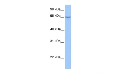 Anti-PML antibody used in Western Blot (WB). GTX05122