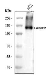 Anti-Laminin gamma 2 antibody used in Western Blot (WB). GTX05123