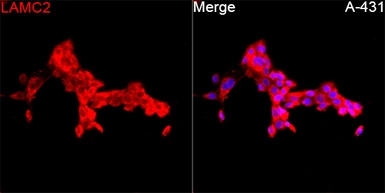 Anti-Laminin gamma 2 antibody used in Immunocytochemistry/ Immunofluorescence (ICC/IF). GTX05124