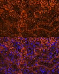 Anti-Laminin gamma 2 antibody used in IHC (Paraffin sections) (IHC-P). GTX05124
