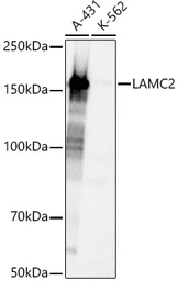 Anti-Laminin gamma 2 antibody used in Western Blot (WB). GTX05124