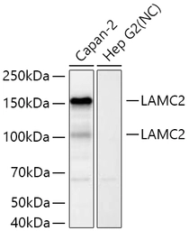 Anti-Laminin gamma 2 antibody used in Western Blot (WB). GTX05125