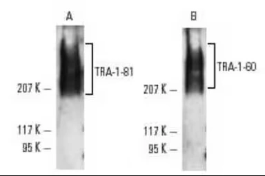 Anti-TRA-1-60 antigen antibody [TRA-1-60] used in Western Blot (WB). GTX05127