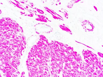 Anti-Muscle Actin antibody [HHF35] (ready-to-use) used in IHC (Paraffin sections) (IHC-P). GTX05129