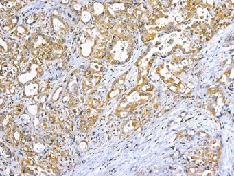 Anti-TNF alpha antibody [DBM15.28] (ready-to-use) used in IHC (Paraffin sections) (IHC-P). GTX05131