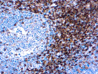 Anti-CD4 antibody [EP204] (ready-to-use) used in IHC (Paraffin sections) (IHC-P). GTX05133