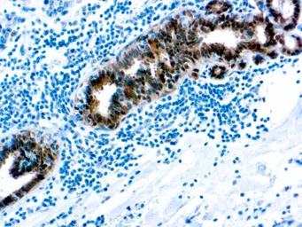 Anti-Hsp70 antibody [W27] (ready-to-use) used in IHC (Paraffin sections) (IHC-P). GTX05136