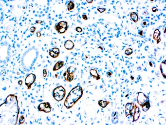 Anti-C4d antibody [C4D204] (ready-to-use) used in IHC (Paraffin sections) (IHC-P). GTX05137