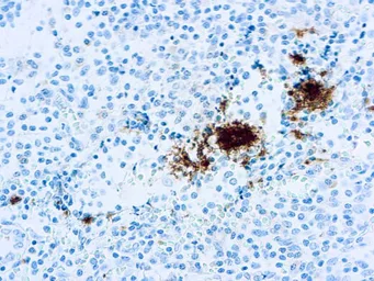 Anti-CD61 antibody [Y2/51] (ready-to-use) used in IHC (Paraffin sections) (IHC-P). GTX05138