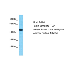 Anti-METTL24 Antibody used in Western Blot (WB). GTX05139