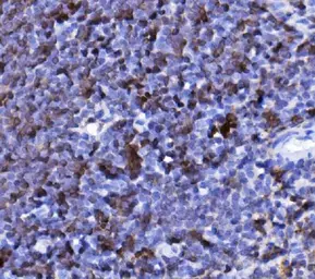 Anti-CD20 antibody used in IHC (Paraffin sections) (IHC-P). GTX05140