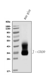 Anti-CD20 antibody used in Western Blot (WB). GTX05140