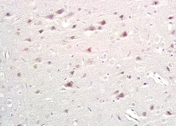 Anti-TPH1 antibody used in IHC (Paraffin sections) (IHC-P). GTX05146