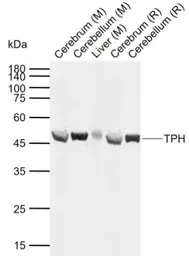 Anti-TPH1 antibody used in Western Blot (WB). GTX05146