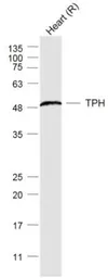 Anti-TPH1 antibody used in Western Blot (WB). GTX05146