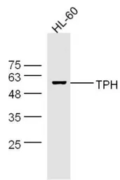 Anti-TPH1 antibody used in Western Blot (WB). GTX05146