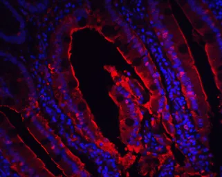 Anti-CDKN2A / p16INK4a antibody used in IHC (Paraffin sections) (IHC-P). GTX05147