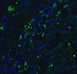 Anti-CDKN2A / p16INK4a antibody used in IHC (Paraffin sections) (IHC-P). GTX05147