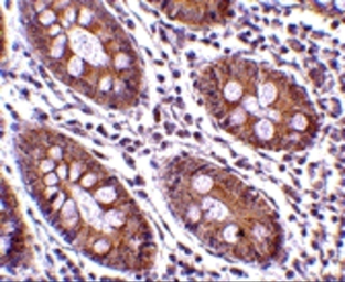 Anti-CDKN2A / p16INK4a antibody used in IHC (Paraffin sections) (IHC-P). GTX05147