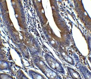Anti-CDKN2A / p16INK4a antibody used in IHC (Paraffin sections) (IHC-P). GTX05147