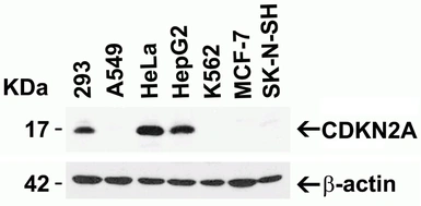 Anti-CDKN2A / p16INK4a antibody used in Western Blot (WB). GTX05147