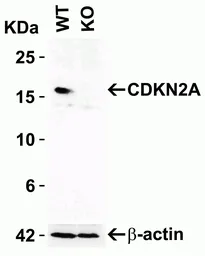 Anti-CDKN2A / p16INK4a antibody used in Western Blot (WB). GTX05147