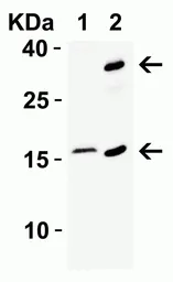 Anti-CDKN2A / p16INK4a antibody used in Western Blot (WB). GTX05147