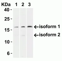 Anti-CDKN2A / p16INK4a antibody used in Western Blot (WB). GTX05147