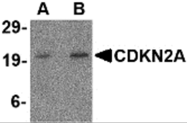 Anti-CDKN2A / p16INK4a antibody used in Western Blot (WB). GTX05147