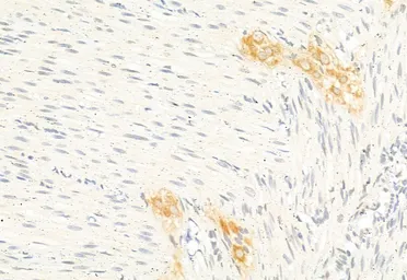 Anti-DRP1 antibody used in IHC (Paraffin sections) (IHC-P). GTX05148