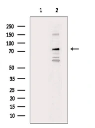 Anti-DRP1 antibody used in Western Blot (WB). GTX05148