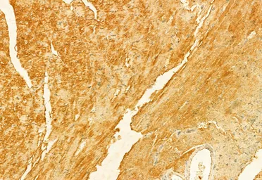 Anti-FIS1 antibody used in IHC (Paraffin sections) (IHC-P). GTX05149