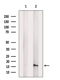 Anti-FIS1 antibody used in Western Blot (WB). GTX05149